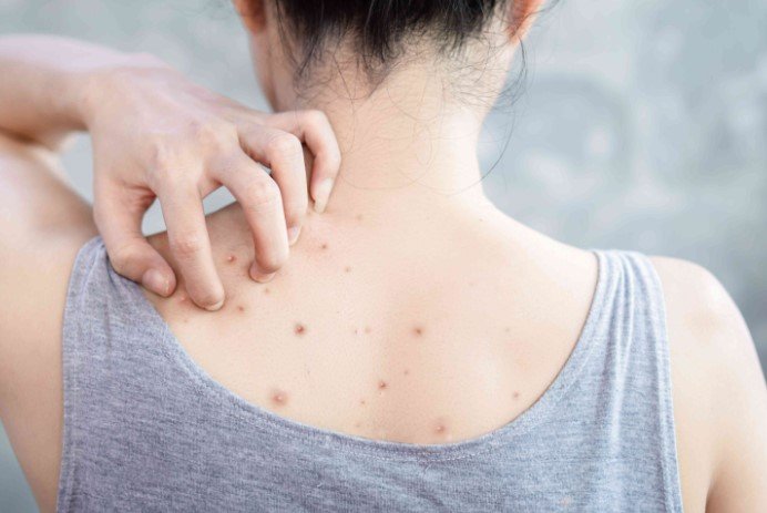 Back Facial Singapore - bacne treatment Singapore