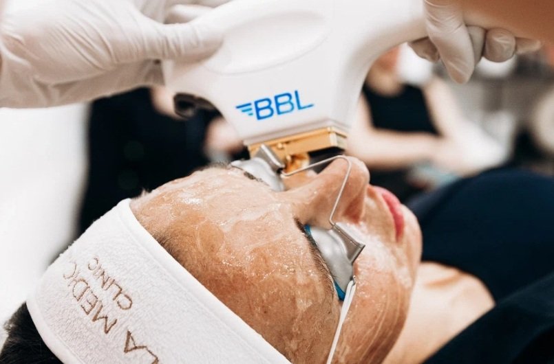 BBL Forever Young Treatment in Manchester – Anti-Aging Solution